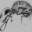 Instant Lobotomy